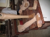 CENTRE FOR HANDICAPPED 2016 PROSTHETIC LEGS